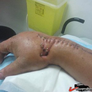 poignet ammoché 1.jpg